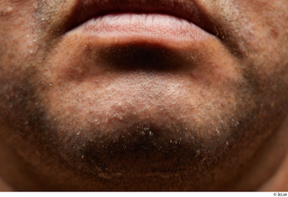 HD face Skin Ian Espinar chin face lips mouth skin…